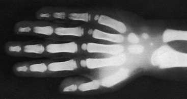 1895 - X-ray-1