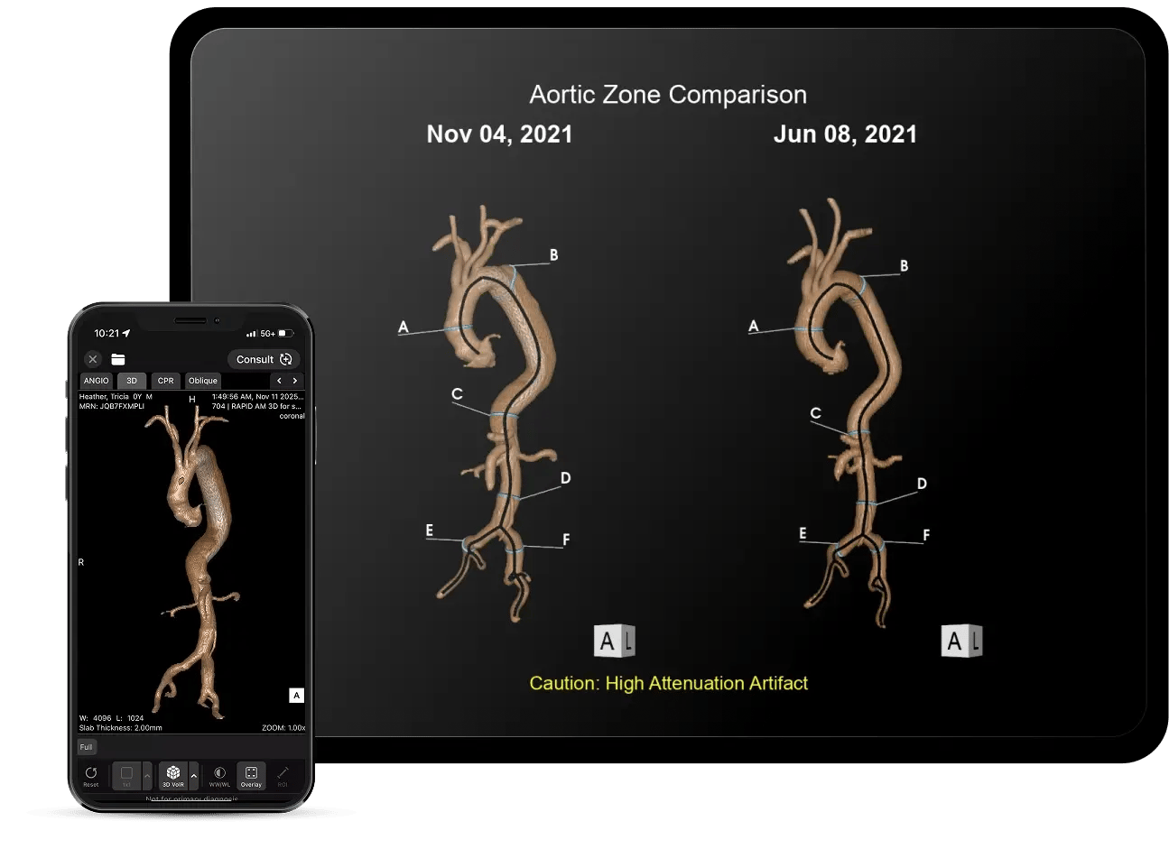 C&V_webpage_Aortic_comparison