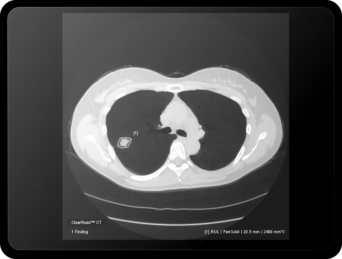 CAC_Case-4_tablet