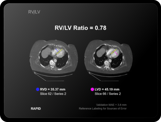 Chest-and-Cardiopulmonary