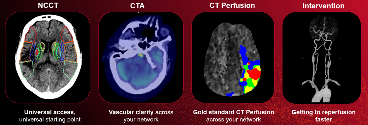 Complete stroke sol 4 image across less copy 0426