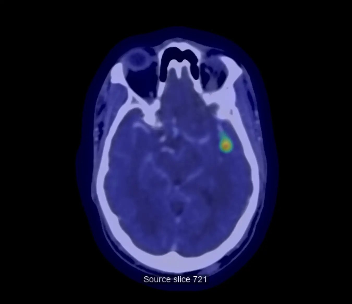 Deep clinical AI Triage v2