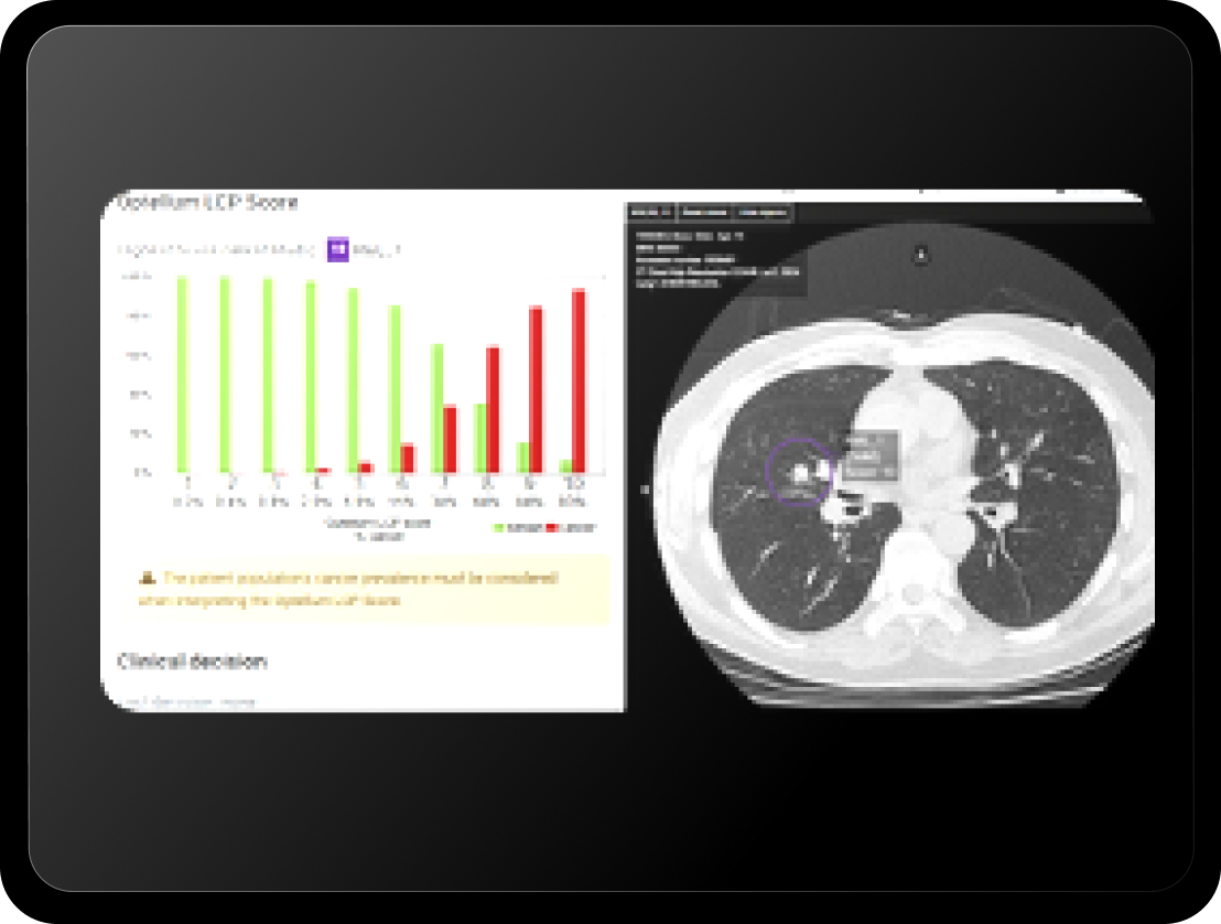 Lung-cancer-clinic-in-tablet_FPO