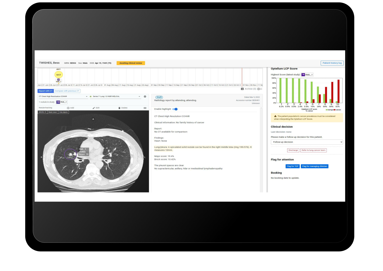 Lung-cancer-clinic-in-tablet_FPO