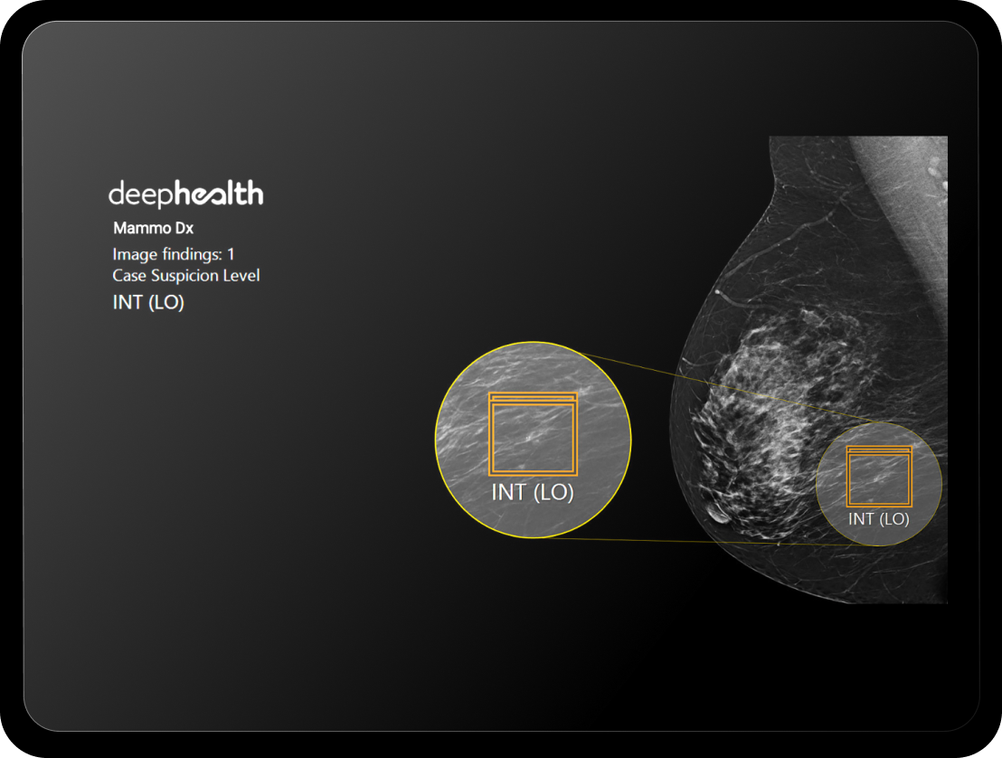 Mammo-Dx-in-tablet_FPO