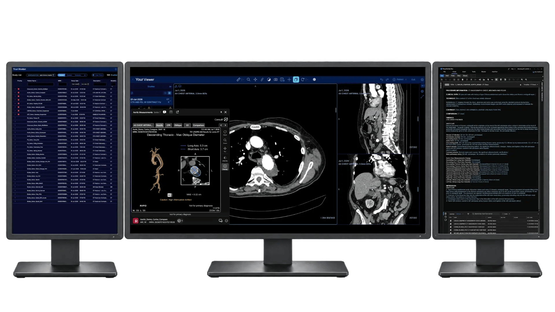 NavPro-Aortic NavPro-Aortic