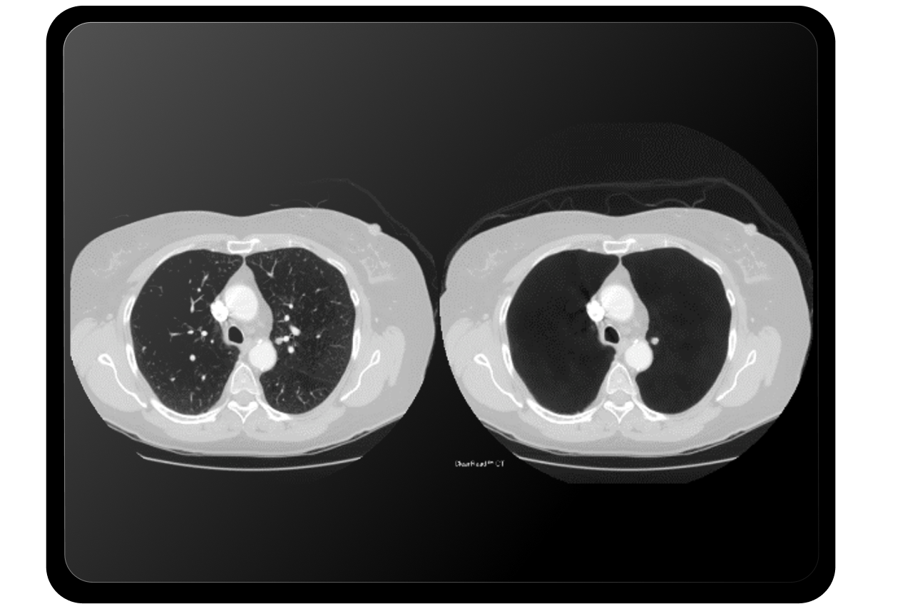 Oncology