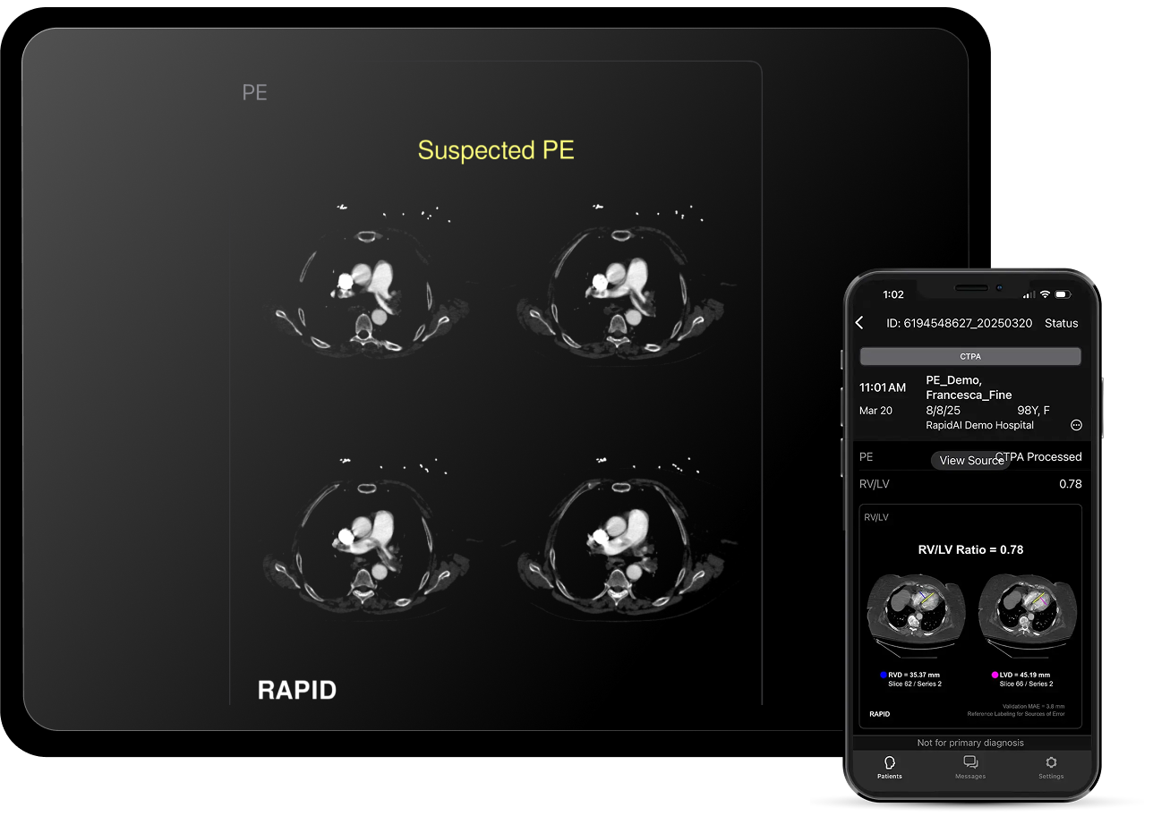 PE-solution-image