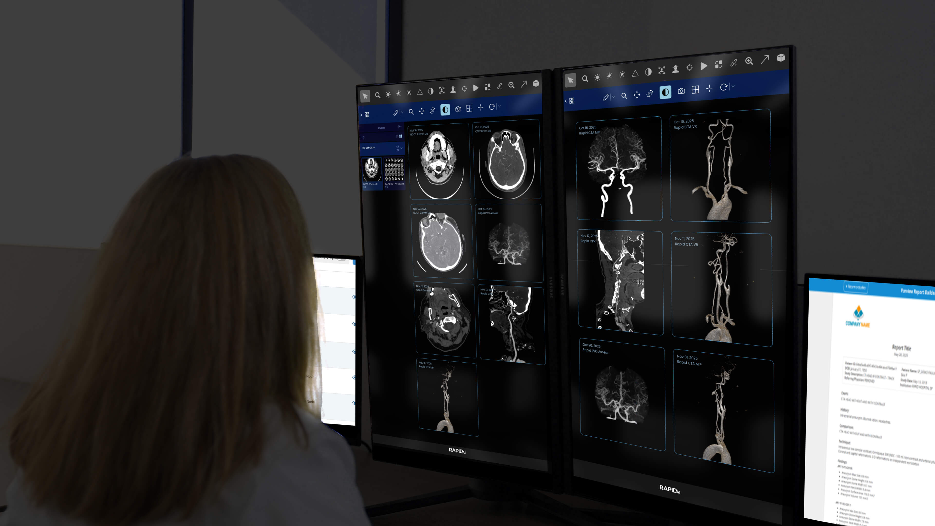 Radiologist at PACS