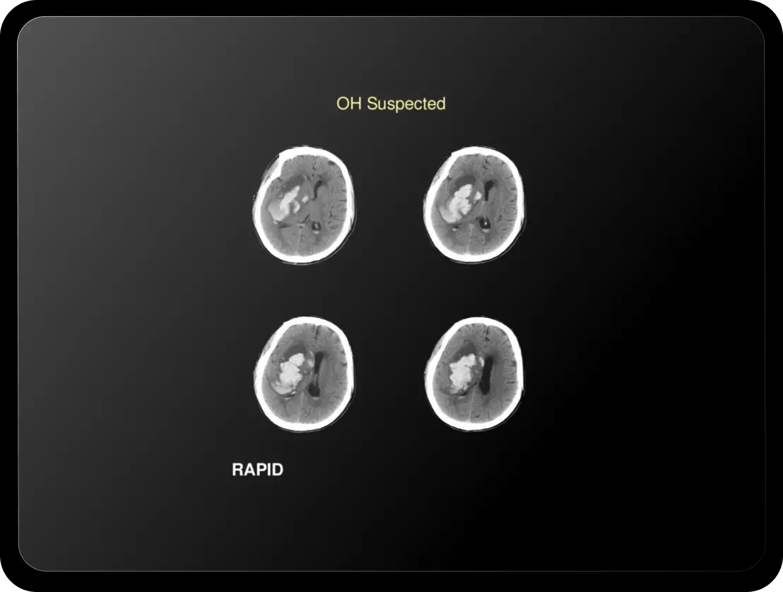 Rapid-OH-Suspected_tablet