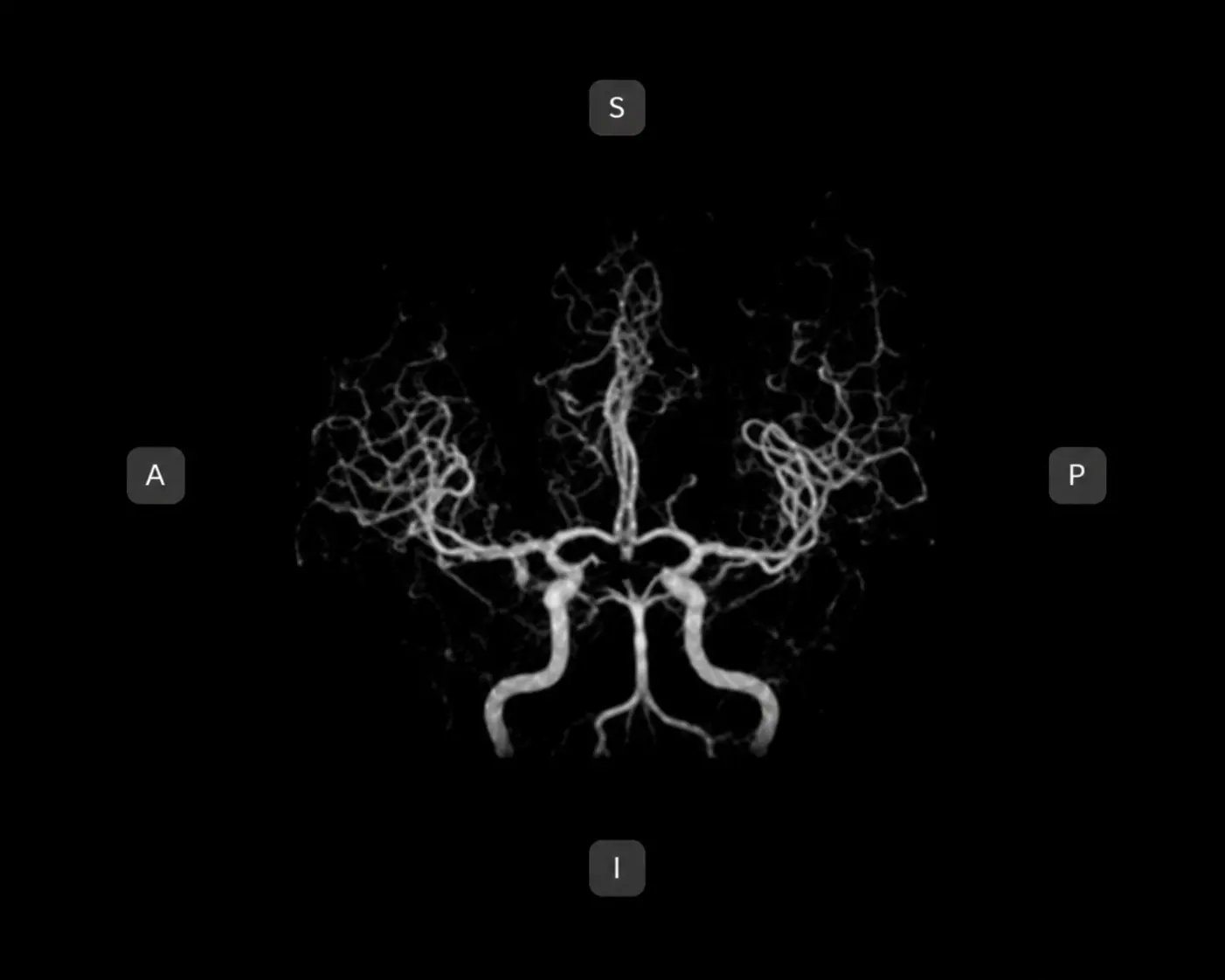 Visualization standard Luminacompare