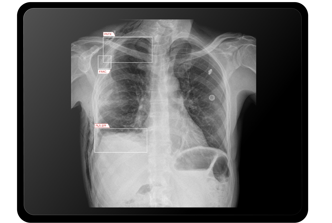 Website_critical-chest-findings
