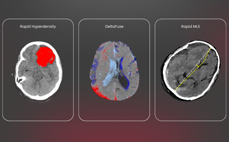 hero-glass-hemorrhagic