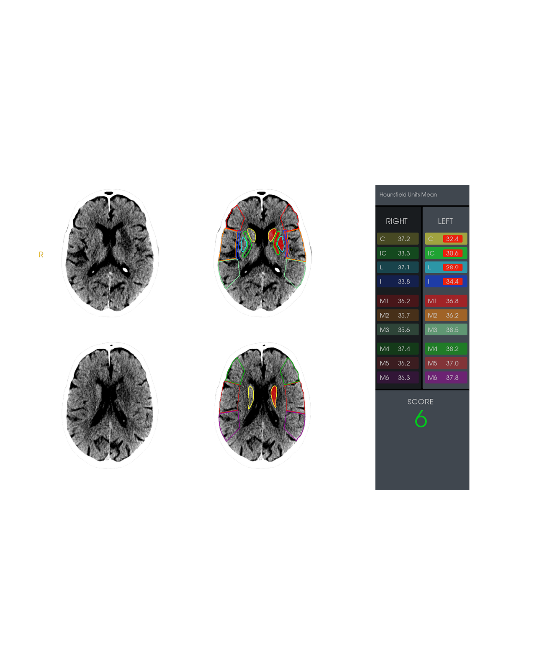 Radiology AI Solutions Redefining Imaging | RapidAI