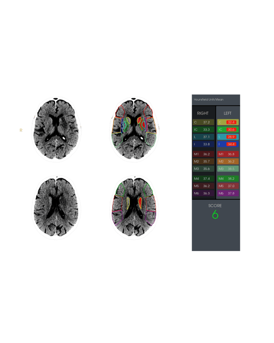 Radiology Ai Imaging Solutions Redefining Medical Imaging With Rapidai