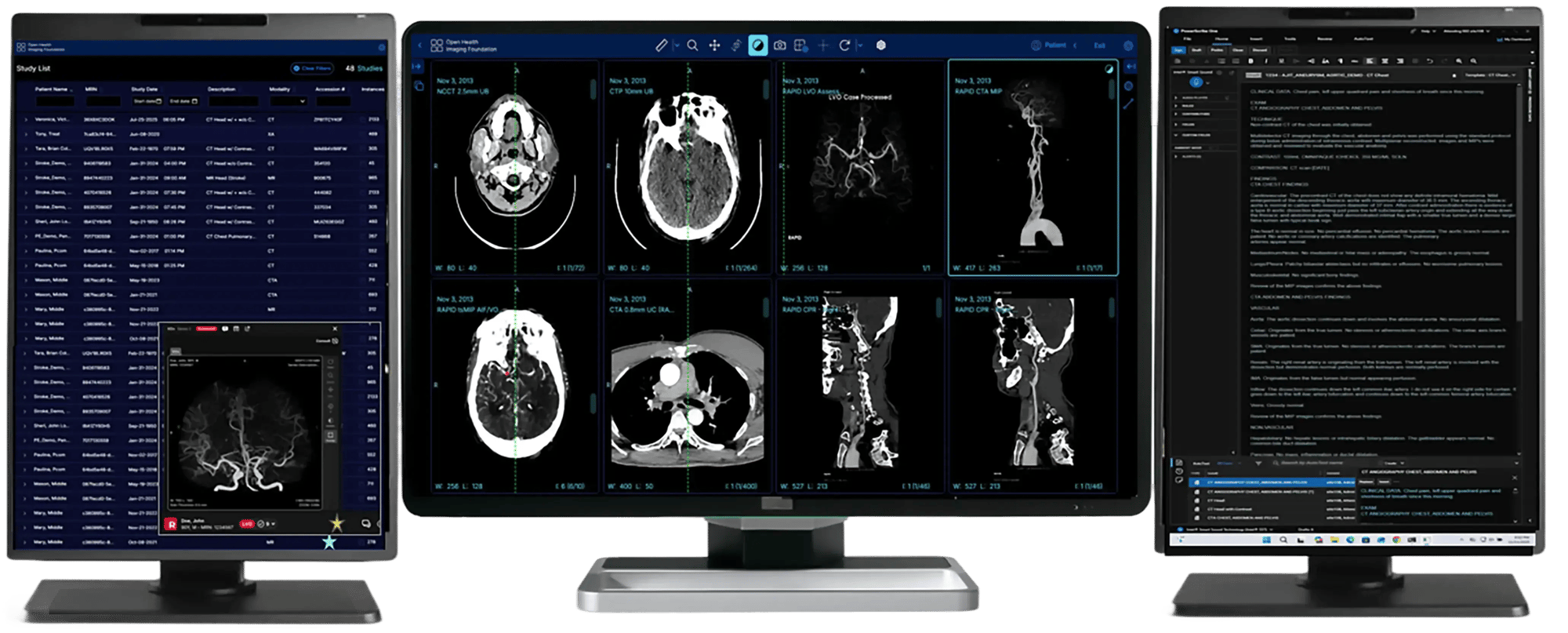 radiology-workstations-new-screens