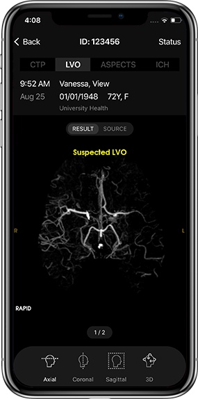 4 LVO_iPhone