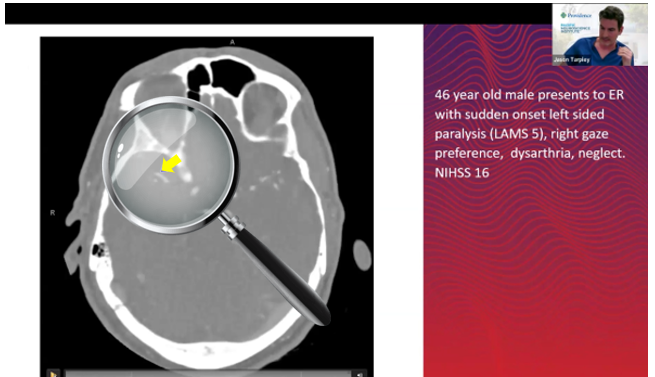 AHA guidelines Mevo detect haystack Tarpley 0426 rev