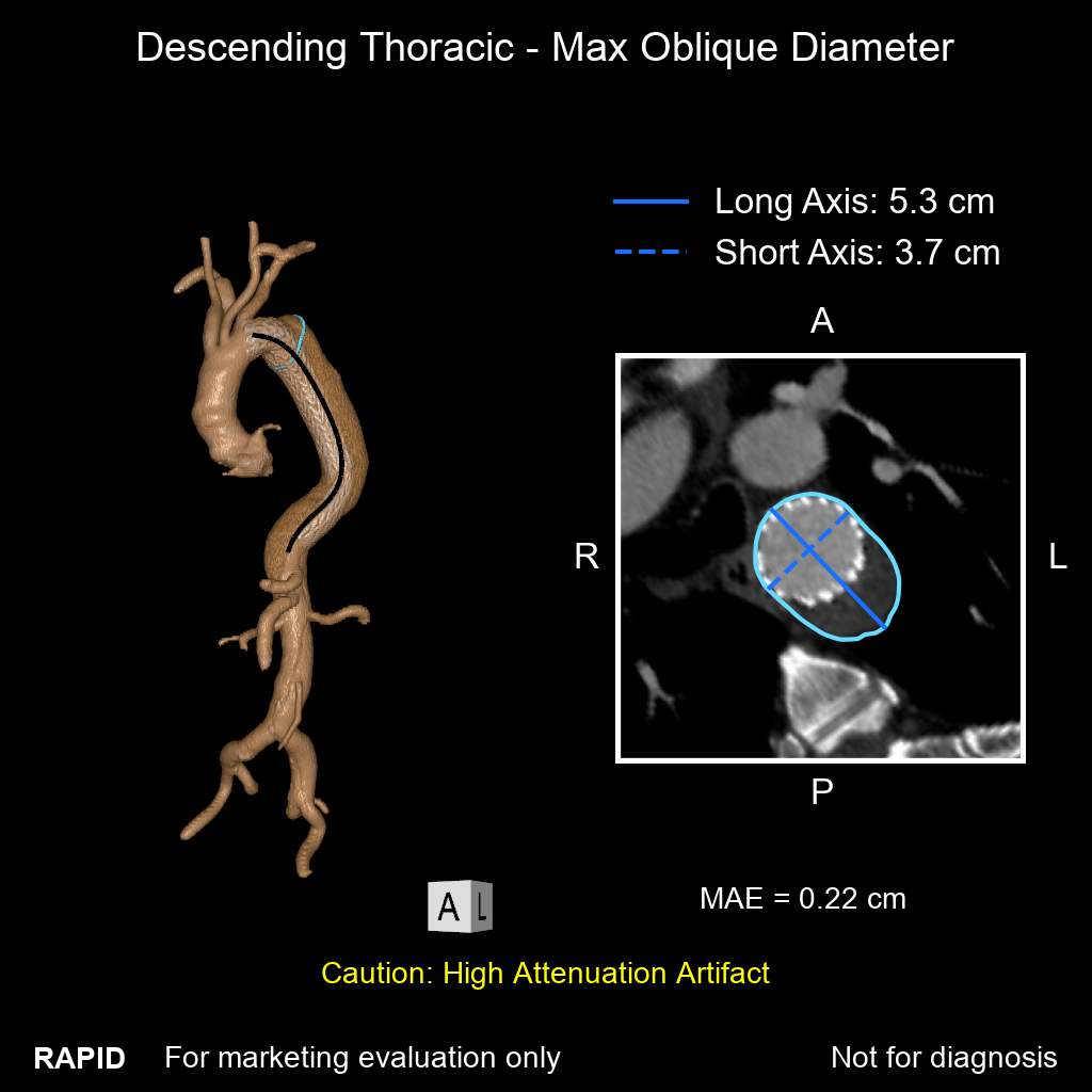Aortic_Quickly-Assess_image_2