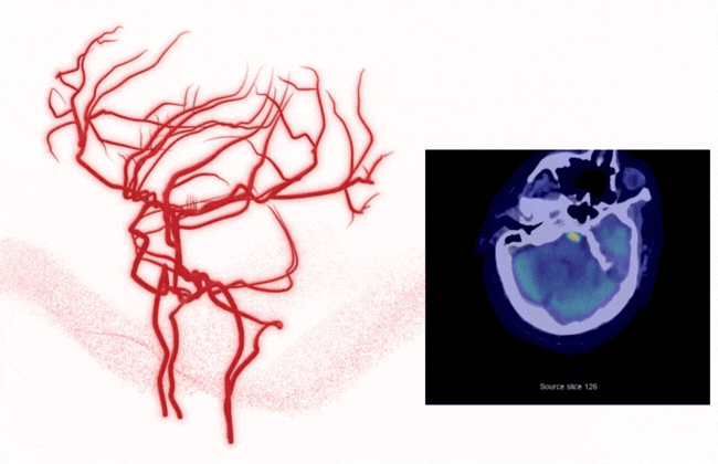 Brain vasculature animated wMEVO image 0426 rev