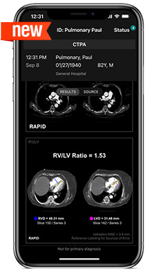 Imaging-CTPA-Results-FDA (1)