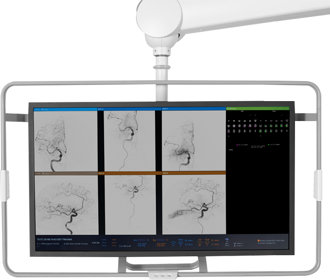 perfusion-imaging