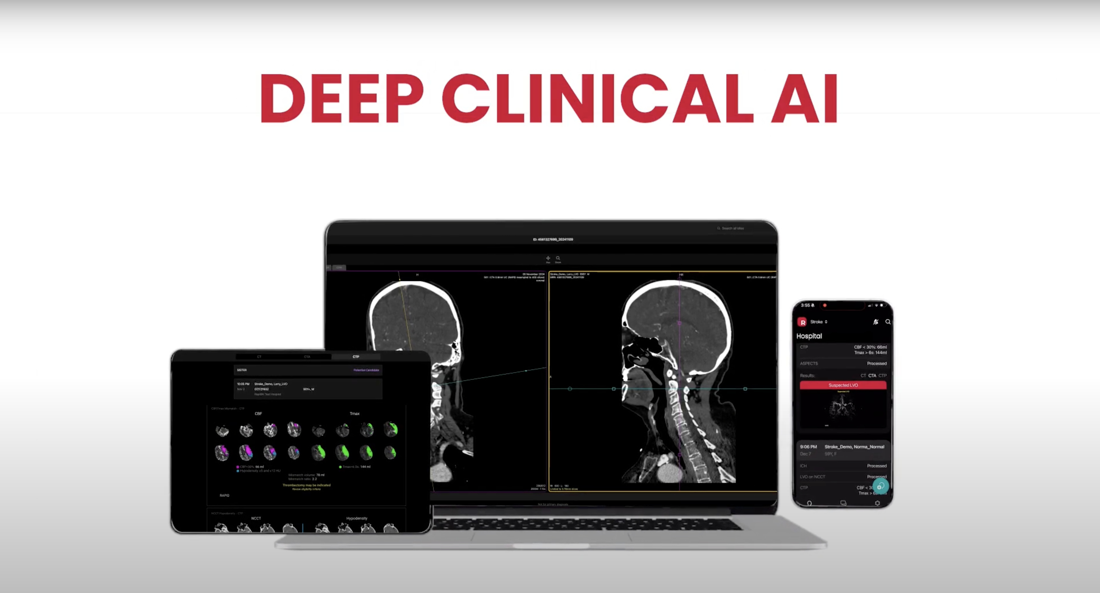 Deep Clinical AI Video Thumbnail