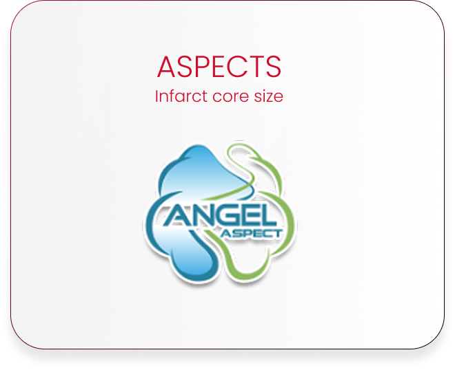 Angel Aspect