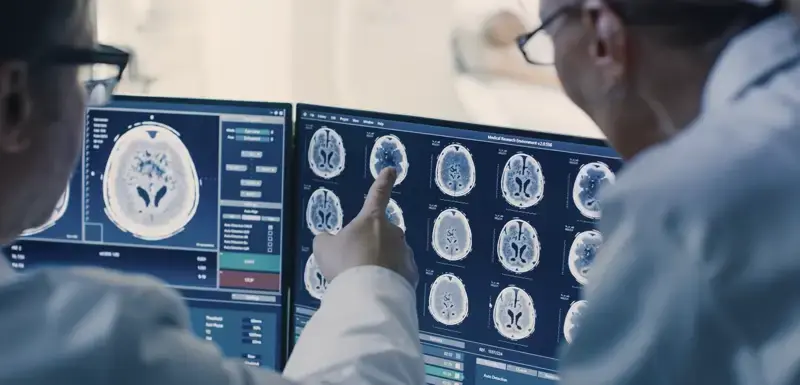 Doctors looking at a computer screen with brain scans