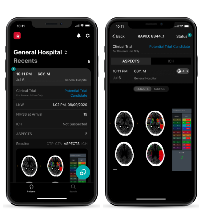 Screenshots of a medical app displaying clinical trial candidate details and brain scan results for a patient at General Hospital.